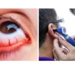 BATALKAH MENGGUNAKAN OBAT TETES MATA DAN TELINGA SAAT BERPUASA?