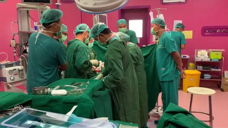 OPERASI PEMISAHAN BAYI KEMBAR SIAM DI RSSA TUNTAS DALAM 1 JAM