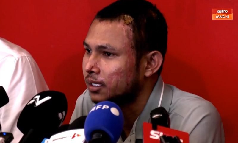 FAISAL HALIM AKHIRNYA MUNCUL KE PUBLIK PASCA INSIDEN PENYIRAMAN AIR KERAS