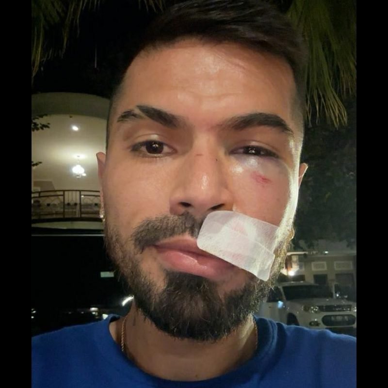 331-Julian Guevara SEMPAT DIBAWA AMBULANS USAI BERBENTURAN SAAT LAGA, BEGINI KONDISI JULIAN GUEVARA